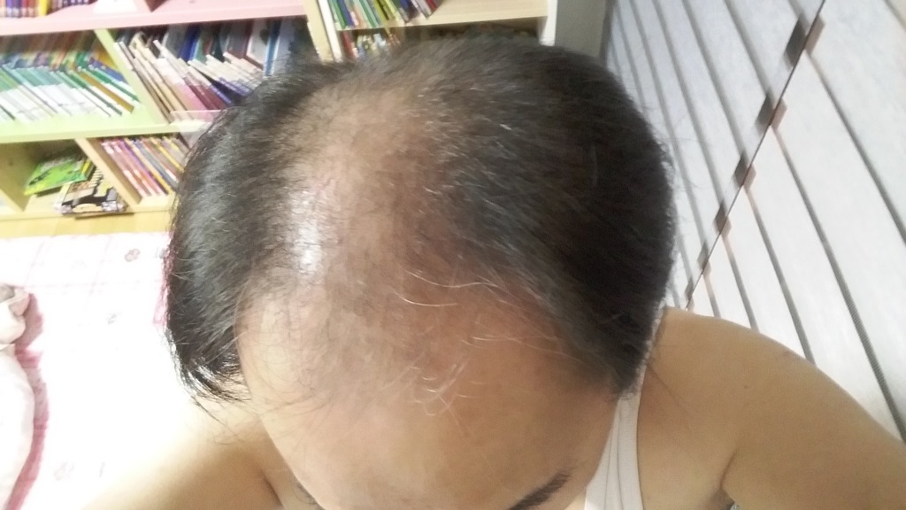 구지포스 이미지