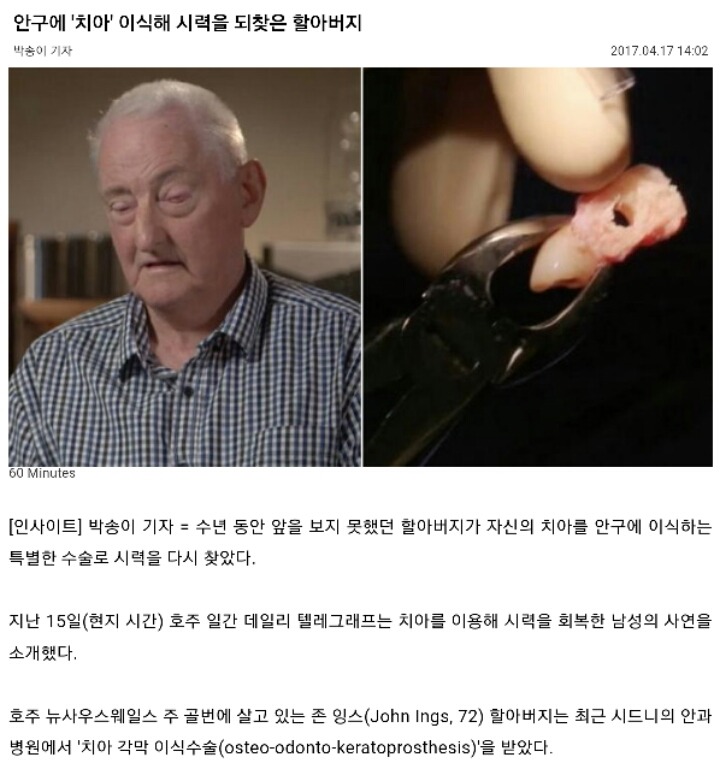 현대 의학의 위엄 | 인스티즈