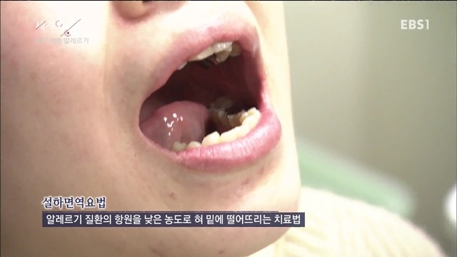 다큐 세계의 눈 - 의학 혁명 알레르기 | 인스티즈
