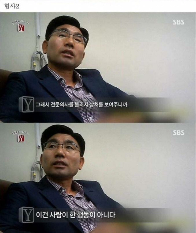 자고 일어나니 발가락이 모두 사라진 남자 | 인스티즈