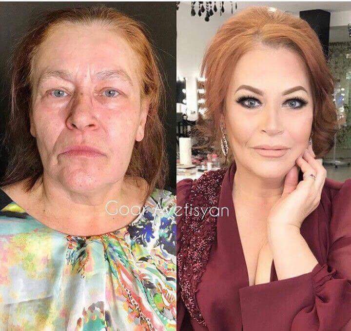 비포에프터 이미지