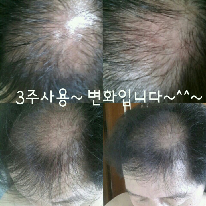 까망머리 이미지