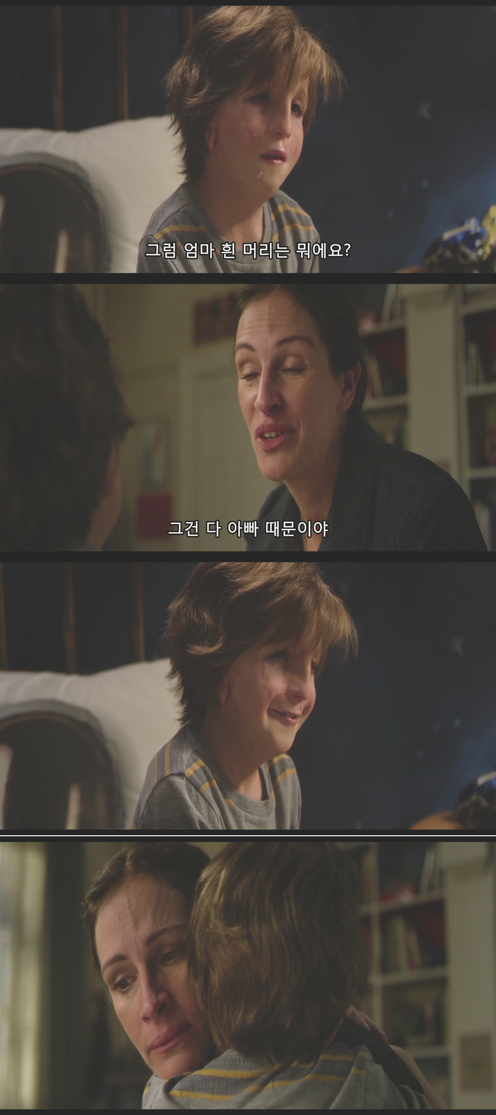 안면기형으로 태어났는데 애들이 너무 괴롭혀서 학교에 가기 싫어요...... jpg | 인스티즈