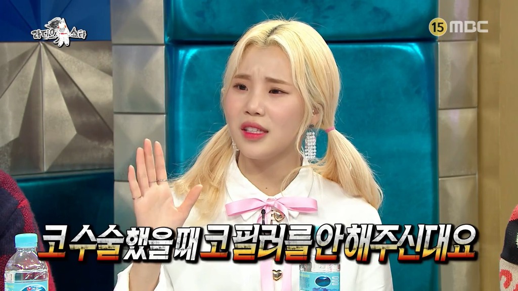 [라디오스타] 코수술 사실을 소속사에 숨겼다가 딱 걸린 주이.jpgif | 인스티즈