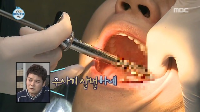 [나혼자산다] 너도나도 공감하는 공포의 사랑니 빼기 | 인스티즈