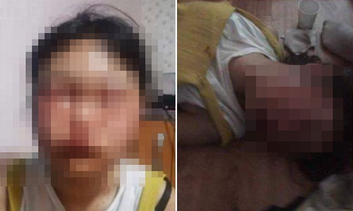 부산 여중생 폭행 이어 강릉서 여고생 집단 폭행사건 발생 | 인스티즈