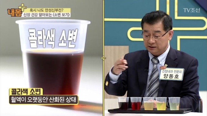 소변 색으로 보는 신장 건강 | 인스티즈